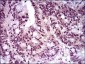 T Antibody